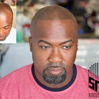 Scalp Micropigmentation is the the best option for hairloss👌

Dm for more info or
Message 📱(954)24