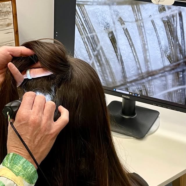 Hair loss doesn’t have to be something you navigate alone! 

At Boss Clinic, your initial consultati