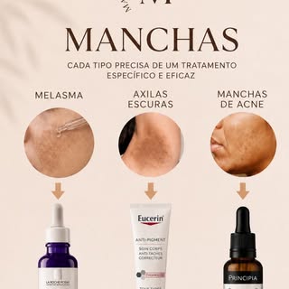 Você trata todas as manchas da mesma forma?

⚠️ Esse é um dos erros mais comuns no skincare.

Cada t