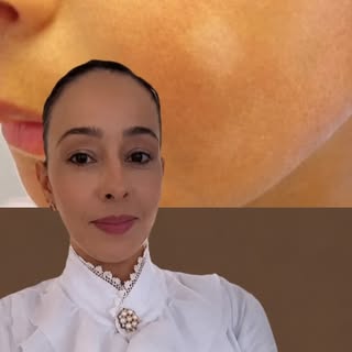 Manchas brancas na pele nem sempre são micose!

Uma causa muito comum é a pitiríase alba, que aparec