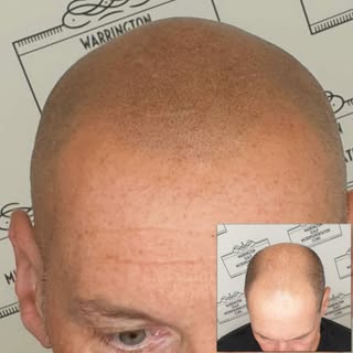 What a great guy, subtle look requested...amazing how many guys just want that natural look... exact
