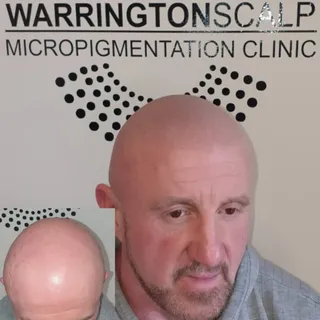 Looking for a hair loss solution??

Sick of being bald??

Many guys want the software and natural lo