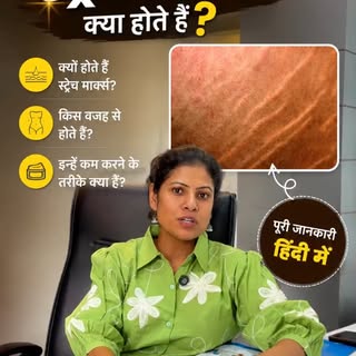 Part1:रेड स्ट्रैच मार्क्स vs व्हाइट स्ट्रैच मार्क्स! 🛑⚪

जब शरीर में तेजी से बदलाव आते हैं जैसे गर्