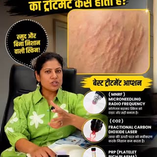Part: 2 Stretch Marks की असली सच्चाई! 🚫 Stop Wasting Money on Creams

सच्चाई यह है कि सिर्फ क्रीम ल