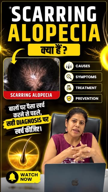 क्या ऑनलाइन हेयर फॉल टेस्ट सच में सही हैं? जानिए डॉक्टर की राय!

क्या आप भी बालों के झड़ने (हेयर फॉल