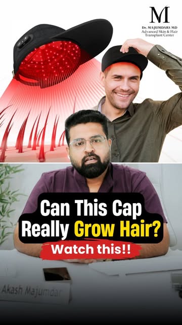 Can wearing a red laser cap actually reverse hair loss and regrow your hair? Or is it just another i
