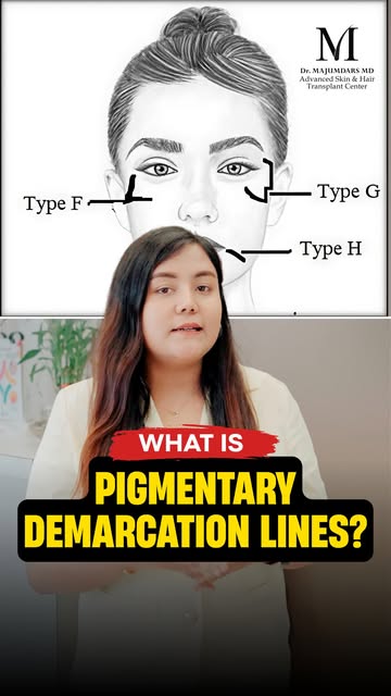 Ever noticed distinct, abrupt borders between darker and lighter skin on your face? 🧐
Watch this vi
