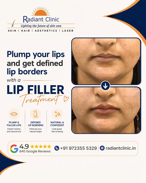 💋 Plump your lips and enhance your natural shape with Lip Filler Treatment at Radiant Clinic! 👄

A