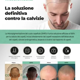 La Micropigmentazione del cuoio capelluto (Tricopigmentazione SMP) è l'unica soluzione efficace al 1