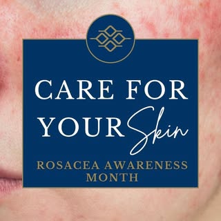 Rosacea Awareness Month

Redness isn’t always just sensitive skin. Rosacea is a common but often mis