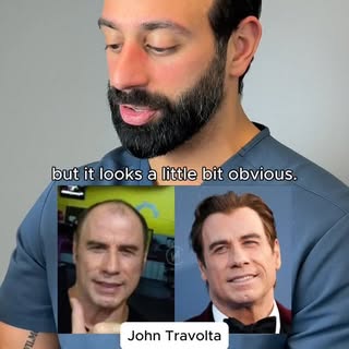 Vancouver hair restoration physician, Dr. Shahil Sood, reviews celebrity transplants