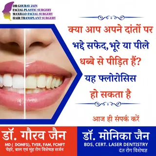 विदिशा का पहला एकमात्र सेंटर जहाँ चेहरे, बाल, मुंह एवं दाँत
से संबंधित ईलाज विशेषज्ञ सर्जन द्वारा हो