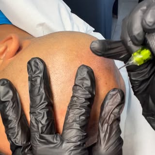 En pleine réalisation d’un effet rasé.

L’objectif : recréer visuellement une implantation homogène 