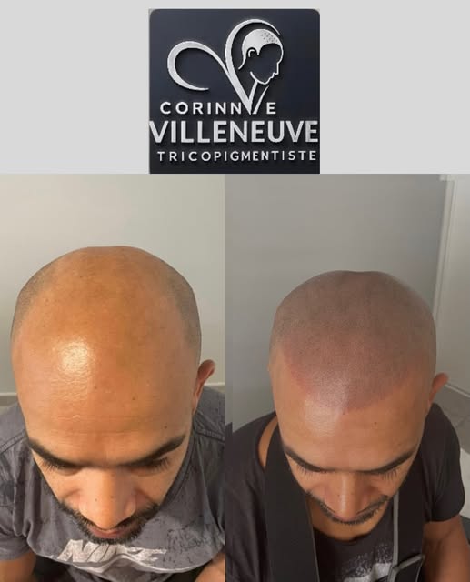 Une transformation visible : une impression de densité, une ligne capillaire redessinée et un résult