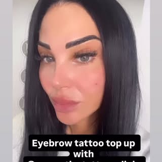 💛 Lovely to welcome beautiful @tulisacontostavlos back into the clinic earlier this month looking f