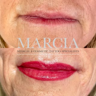 🩶 LIPBLUSH TREATMENT 
🤍 Wake up with beautifully tinted lips every day 
🩶 Say goodbye to dull, un