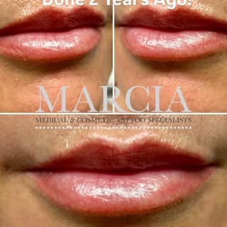 🤍 LIPBLUSH TREATMENT DONE OVER 2 YEARS AGO‼️
🩶 Still looking fabulous! 
🤍 Wake up with beautifull