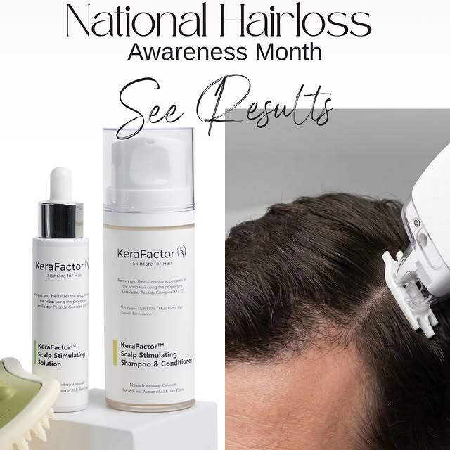 August is National Hair Loss Awareness Month. 
It is a time to talk about hair thinning and loss. We