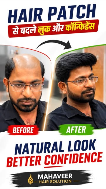 Hair transformation by @mahaveer_hair_solution_ #fyb #explore #instagram #trandingreels♥️ #look