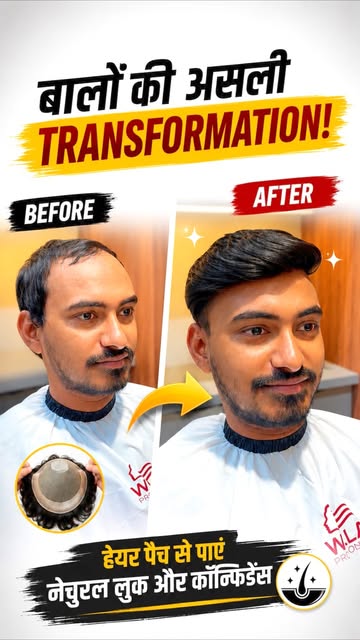 Hair transformation by @mahaveer_hair_solution_ #fyb #instagram #trandingreels♥️ #explore #look