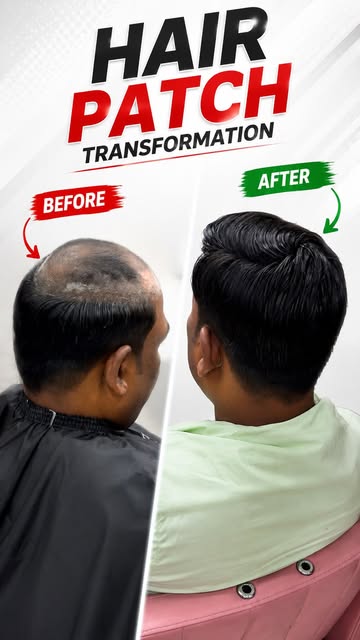 Hair transformation by @mahaveer_hair_solution_ #instagram #explore #fyb #trandingreels♥️ #look
