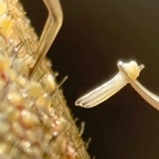 Doğal bir saç ekiminin en önemli aşamalarından biri: greftlerin doğru açı ve yönde, titizlikle yerle