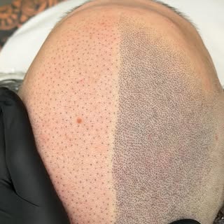 Differenza tra prima e seconda sessione