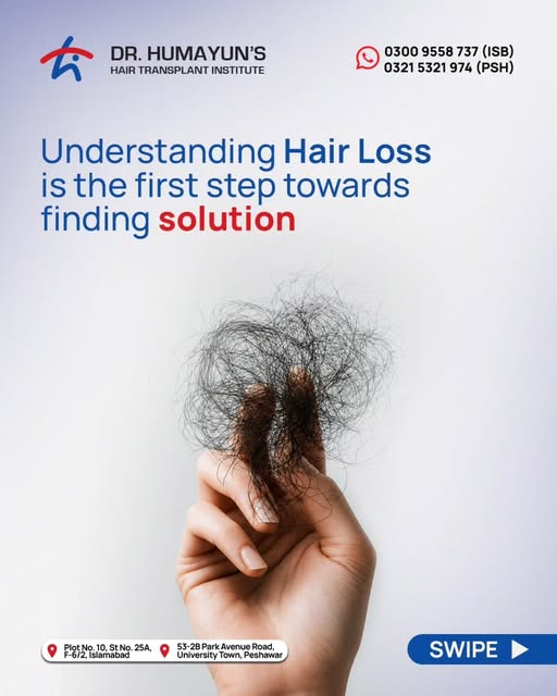 Hair loss can look different for everyone, and understanding what’s behind it is the first step towa