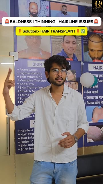 Hair Transplant doesn’t always have to cost lakhs! 👀

Wondering how quality hair transplant options