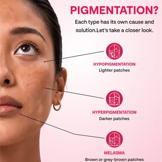 Not all dark spots are the same. ✨

Pigmentation can appear in different forms — hyperpigmentation, 