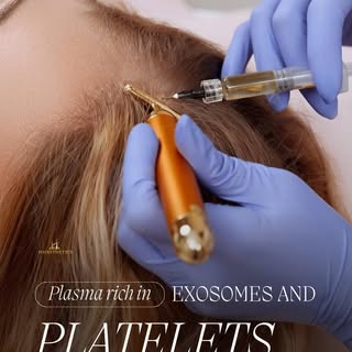 Hair Restoration with Plasma Rich in Exosomes & Platelets ⚡️

Revitalize your scalp and stimulate na