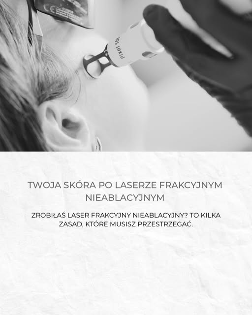 Zabieg to początek procesu 🤍

Równie ważna jak sama terapia jest odpowiednia pielęgnacja skóry po j