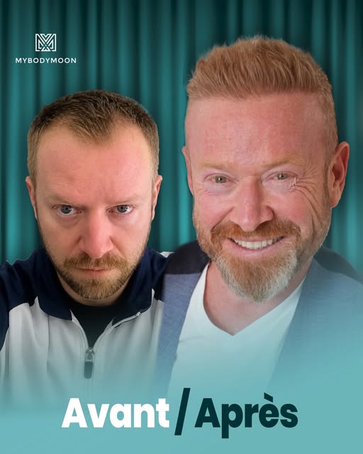 ✨ Avant ➡️ Après
Une transformation naturelle qui fait toute la différence.
Des cheveux plus denses,