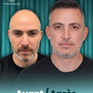 ✨ Avant ➡️ Après

Une transformation naturelle qui fait toute la différence.
Des cheveux plus denses