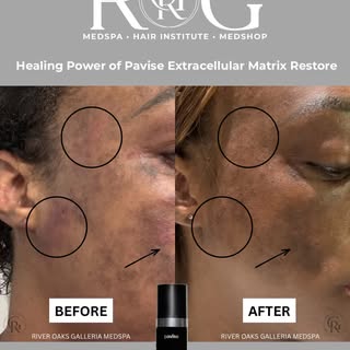 One of my greatest passions is skin transformation—helping patients improve the health of their skin