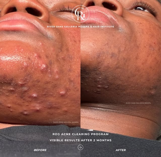 Before & after photos show the change. We want you to understand what created it.

Every patient sta
