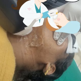 Unwanted Hair removal