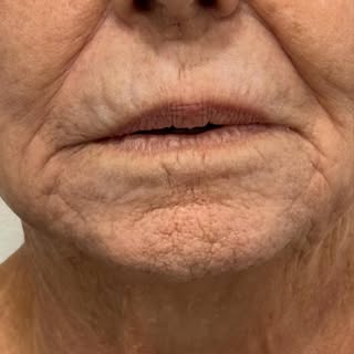 Labios en personas mayores.