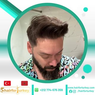 Le résultat de notre patient du Brésil🇧🇷 
Hair For Turkey Clinic casablanca 

🇫🇷 Greffe de cheve