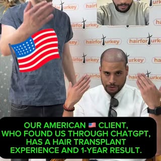 Notre client américain, qui a subi une greffe de cheveux, affirme nous avoir trouvés via ChatGPT. 

