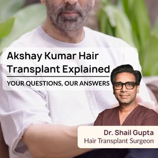 Did Akshay Kumar get a hair transplant?
The real question is how good results are defined.

A truly 