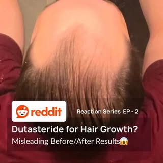 Would you trust a 4.5 month transformation if the angles and hairstyle changed?

Everyone loves a dr