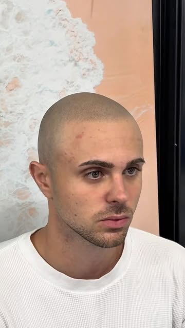 Did we save his hairline⁉️ 

@derekbogs X Los Angeles, CA

#hairtattoo #scalpmicropigmentation #scal