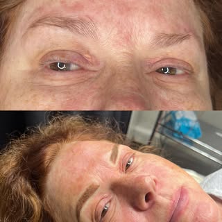 We love a natural transformation 🥰 Book your appointment today!
#atlantabrow #atlantabrows #atlanta