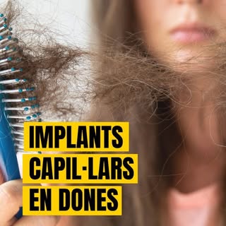 “Les dones amb alopècia ho porten amb por i angoixa”. Parlem amb la Marina Garrido, [@dra.marinagarr