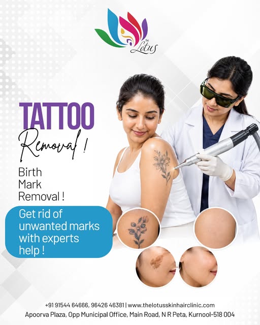 ✨ Unwanted Tattoo or Birthmark? Looking for a Safe Removal Option?

Tattoos and birthmarks can somet