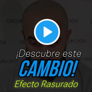 🎥 ANTES Y DESPUÉS – MICROPIGMENTACIÓN CAPILAR 🎥

En este vídeo puedes ver el resultado real de uno