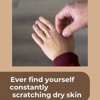 Constant itching, dry patches, and irritated skin may be signs of atopic dermatitis or eczema. Manag
