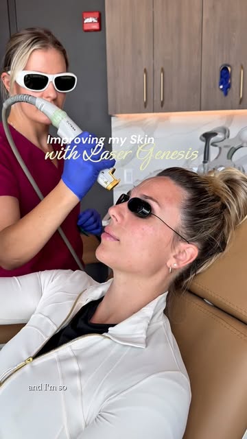 I’ve tried so many different things for my skin over the years, but facial lasers are something I’ve