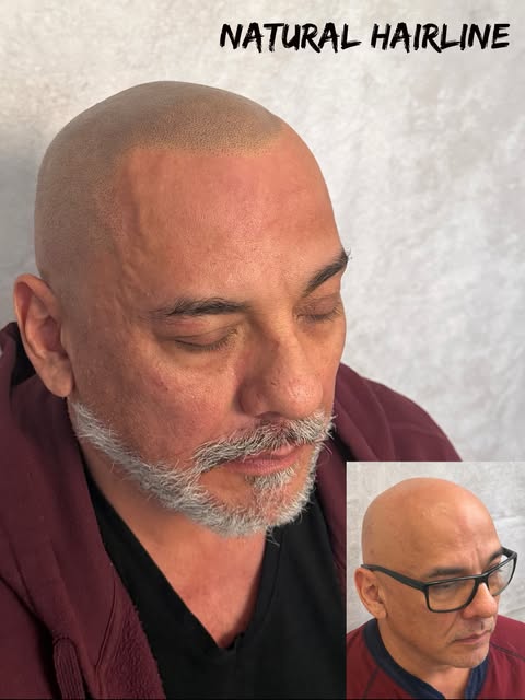 Supernatural age-appropriate @folicule 22 delusion @bishopsmp 04 needles, and SMP power wand #baldhe